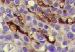 CA19-9/Sialyl Lewis A Antibody (CA19.9/1390R) NBP2-53220