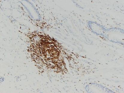 B220/CD45R Antibody (PTPRC/1783R) NBP2-53303