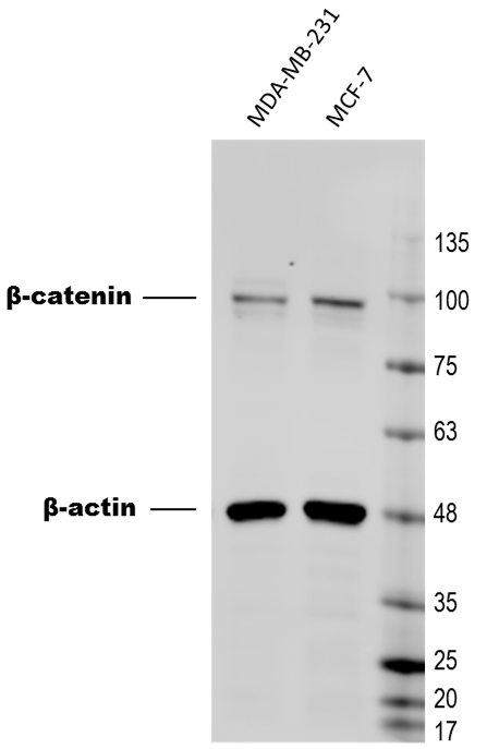 beta-Catenin Antibody (CTNNB1/1509) NBP2-53366