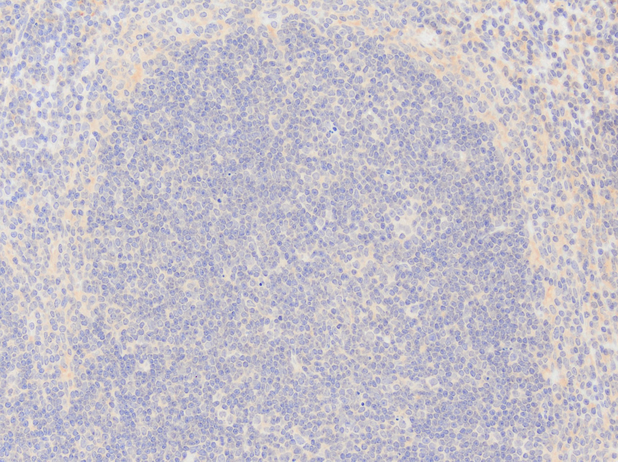 CD3 epsilon Antibody (C3e/1308) [Biotin] NBP2-54392B