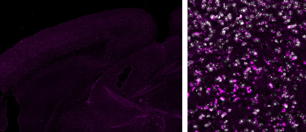 S100B Antibody (S100B/1706R) [Alexa Fluor® 647] NBP2-54426AF647