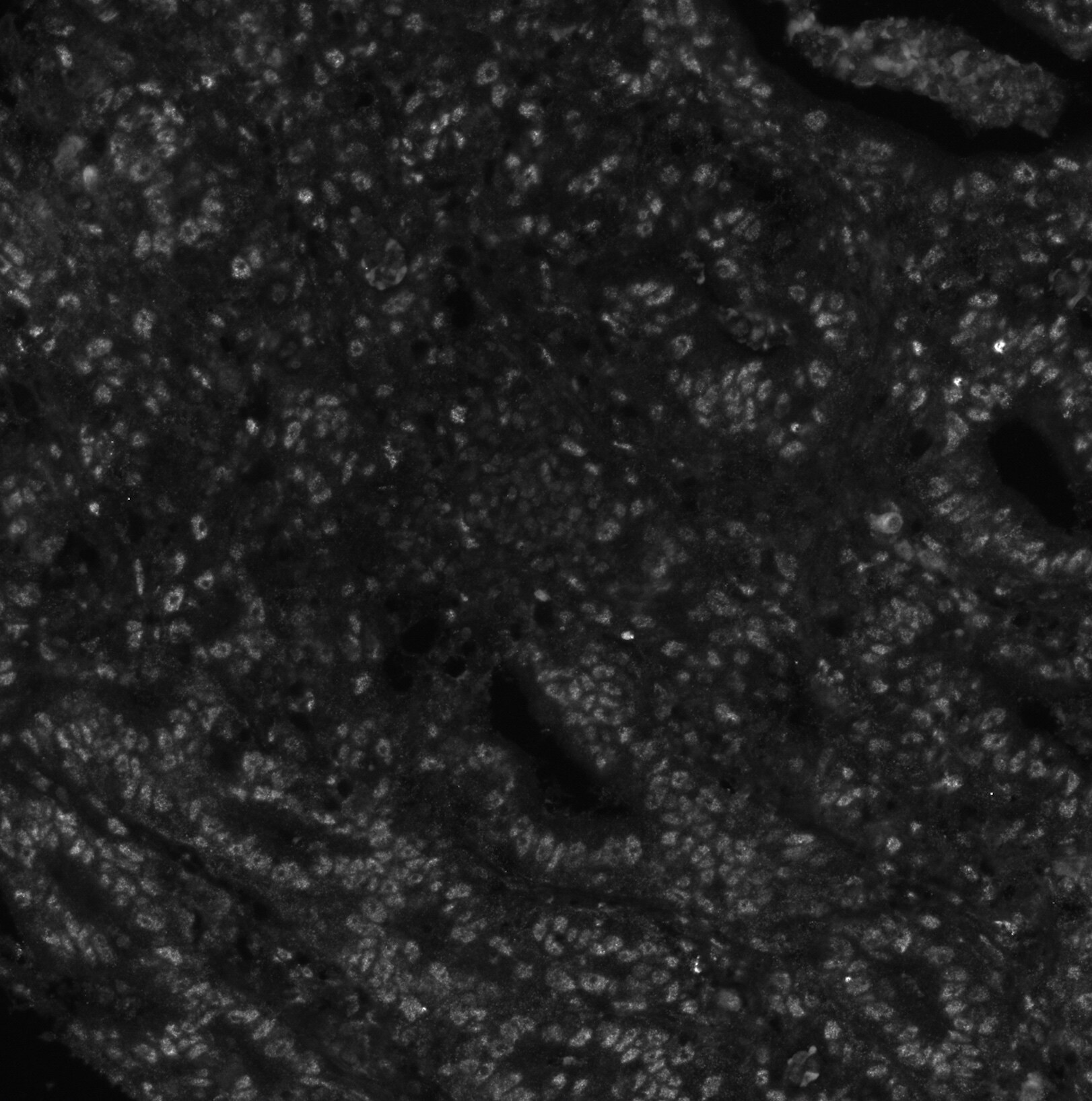 CDX2 Antibody (CDX2/1690) - Azide and BSA Free NBP2-54472