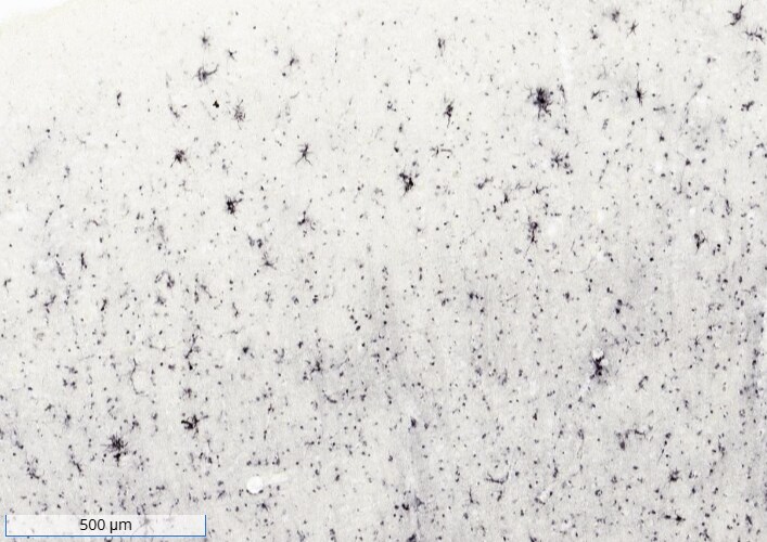 Ferritin Light Chain Antibody (FTL/1386) - Azide and BSA Free NBP2-54574