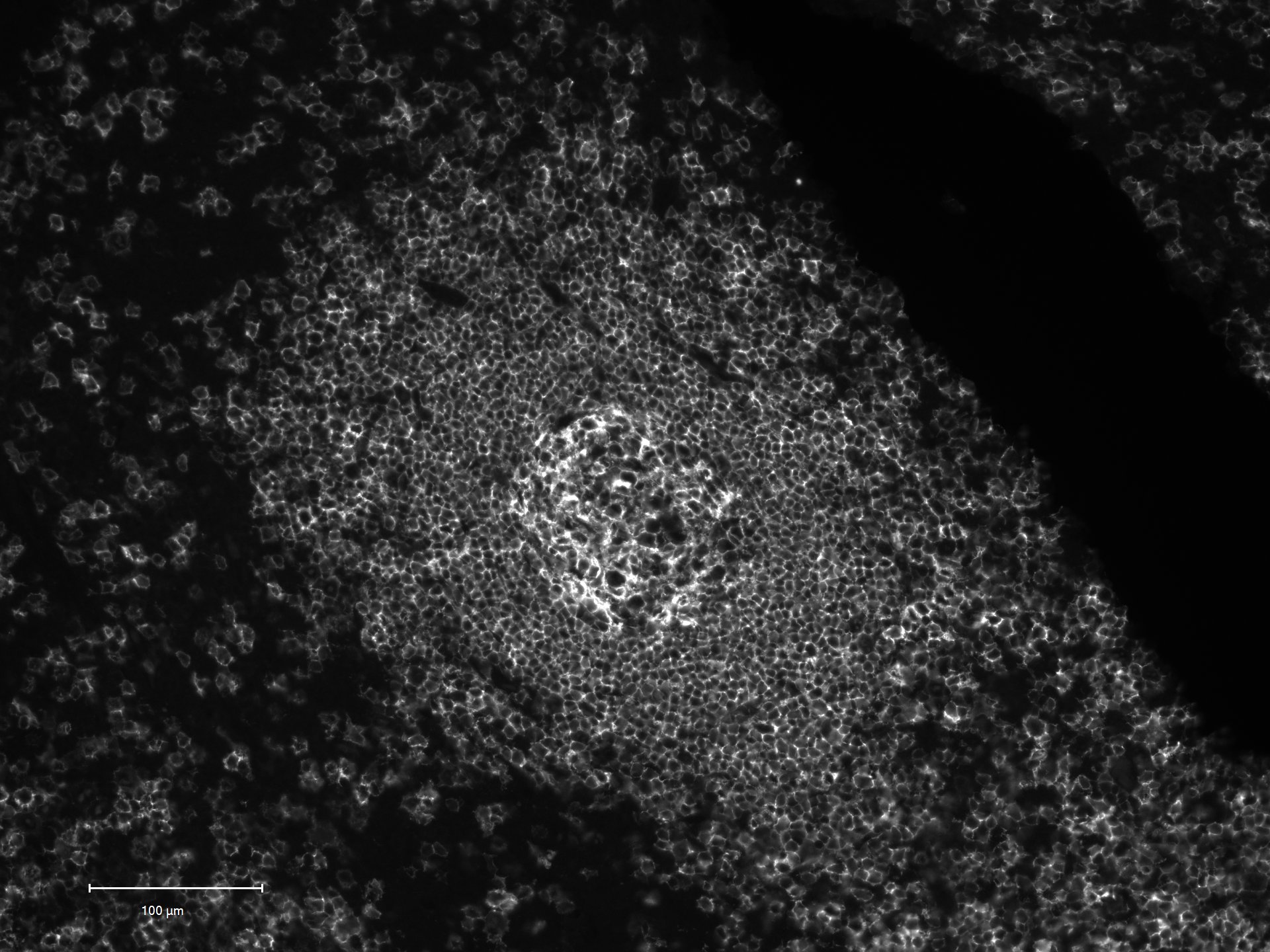 CD20 Antibody (rIGEL/773) - Azide and BSA Free NBP2-54591