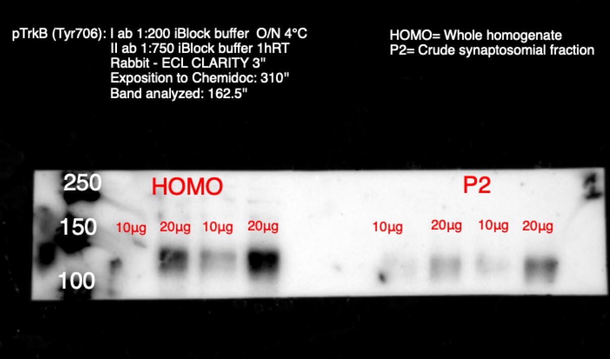 TrkB [p Tyr707, p Tyr706] Antibody - BSA Free NBP2-54764