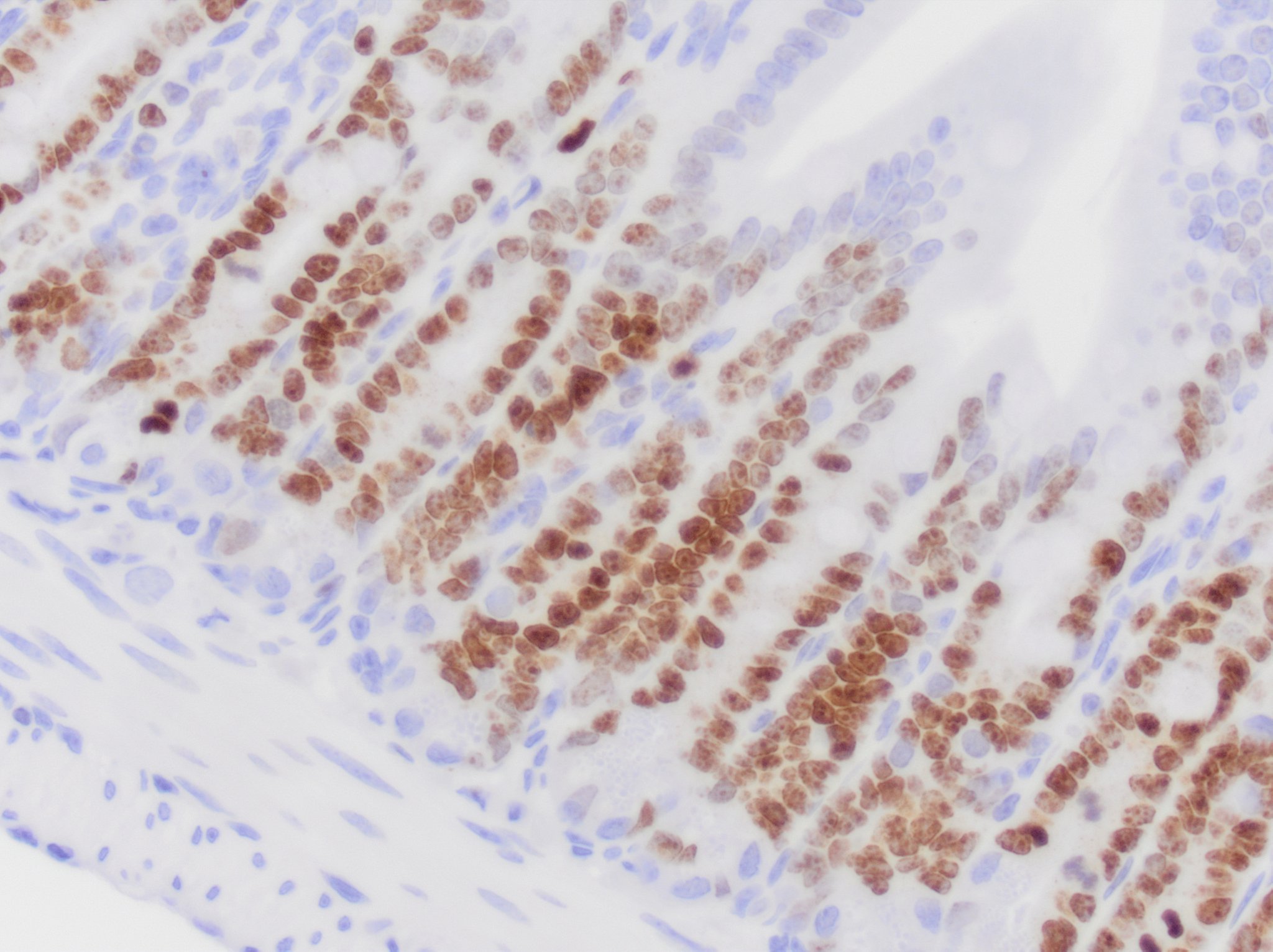 Ki67/MKI67 Antibody (1297A) - BSA Free NBP2-54791