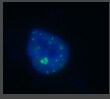 FANCD2 Antibody (1290D) - BSA Free NBP2-54808