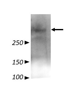 VPS13B Antibody - BSA Free NBP2-55104