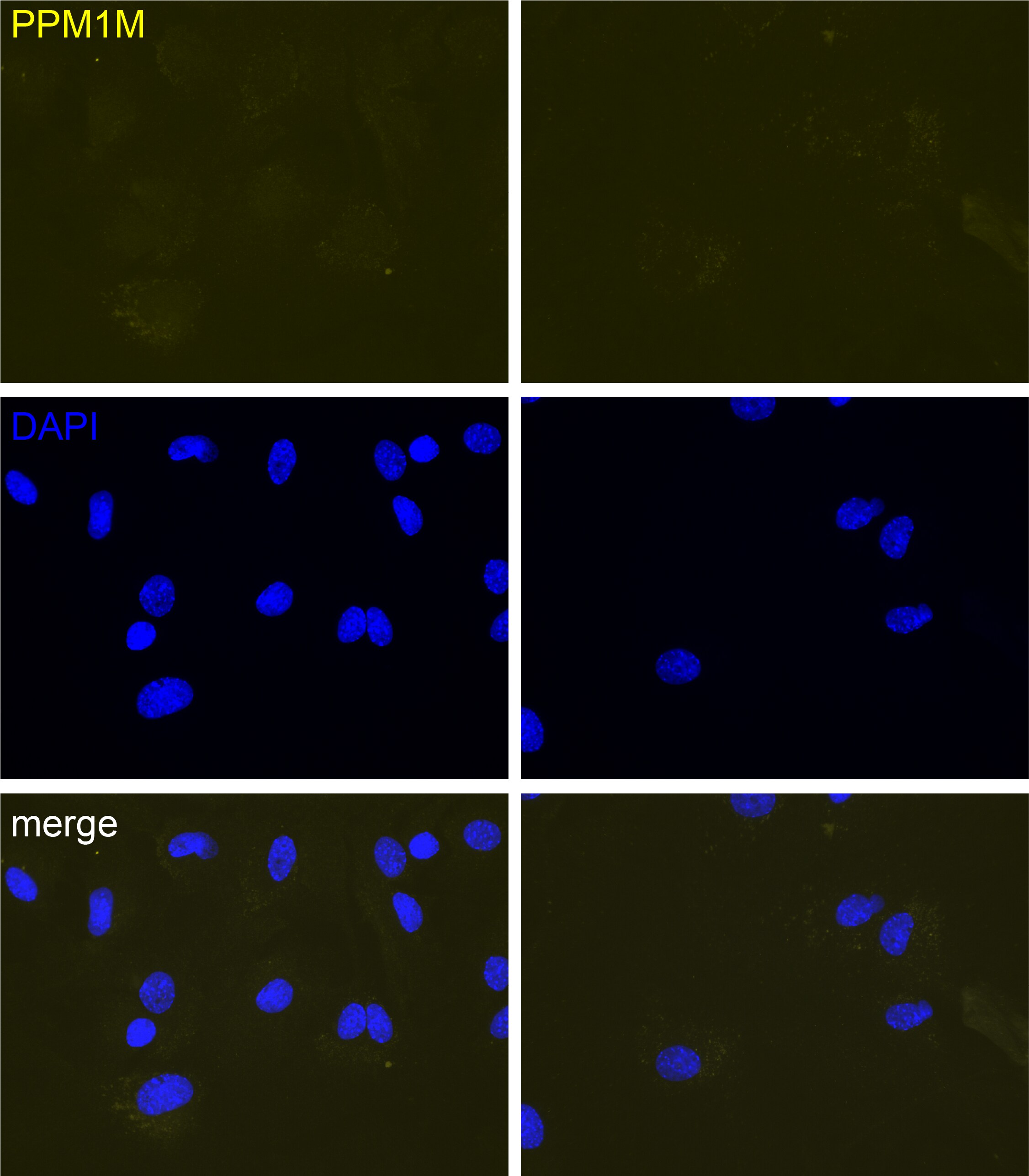 PPM1M Antibody - BSA Free NBP2-56555