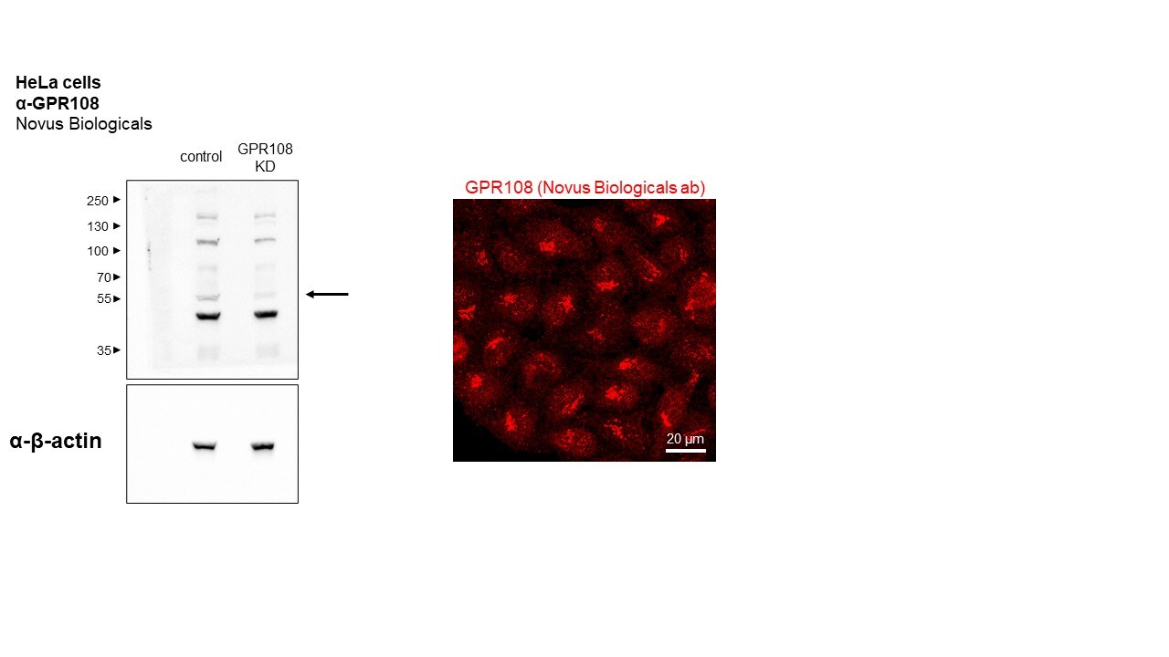 GPR108 Antibody - BSA Free NBP2-56970