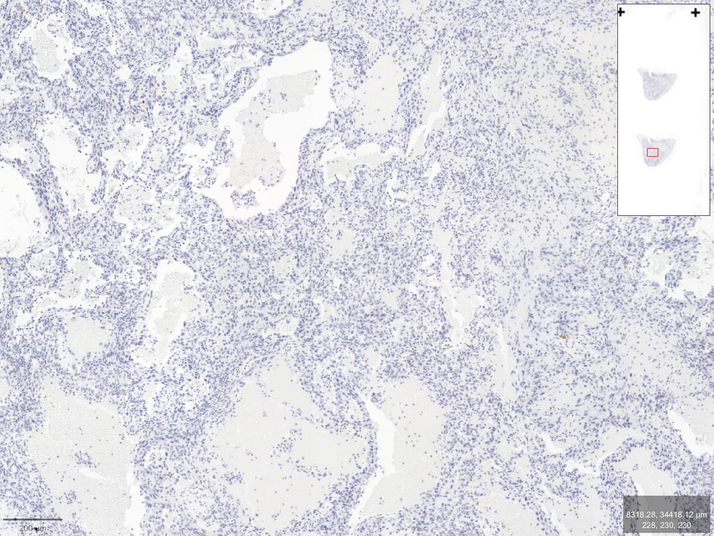 TM4SF18 Antibody - BSA Free NBP2-57543