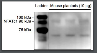 NFATC1/NFAT2 Antibody - BSA Free NBP2-57739