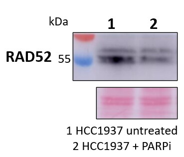 RAD52 Antibody - BSA Free NBP2-58116