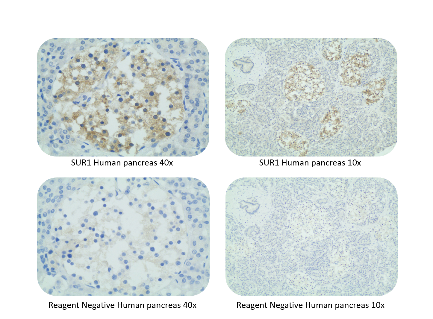 SUR1 Antibody (S289-16) - BSA Free NBP2-59320