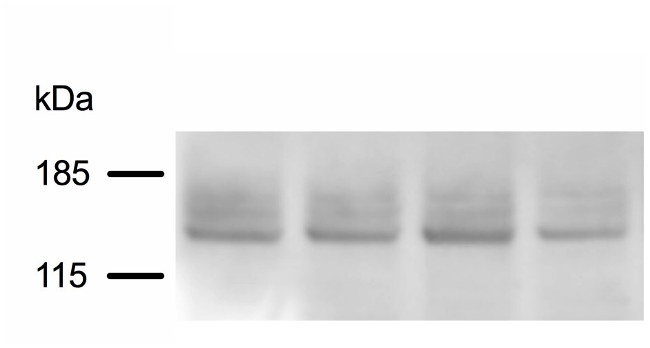 SUR1 Antibody (S289-16) - BSA Free NBP2-59320