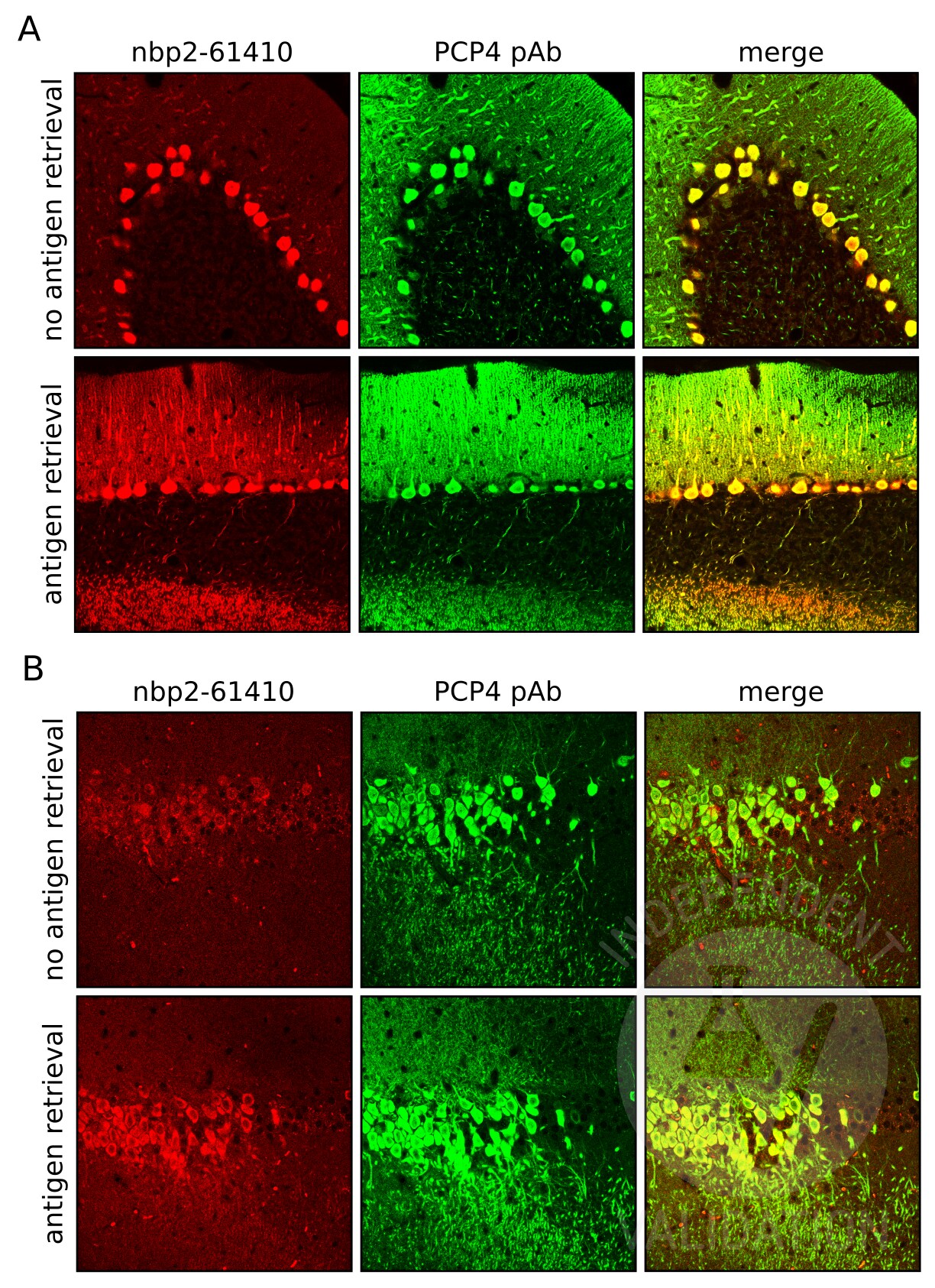 PCP4 Antibody (CL5306) - BSA Free NBP2-61410