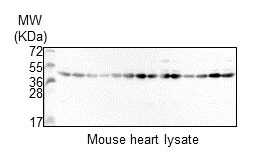 Actin Alpha 1 Cardiac Muscle Antibody (RM257) NBP2-61474