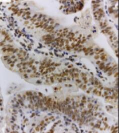 STAT3 [p Tyr705] Antibody (RM261) NBP2-61588