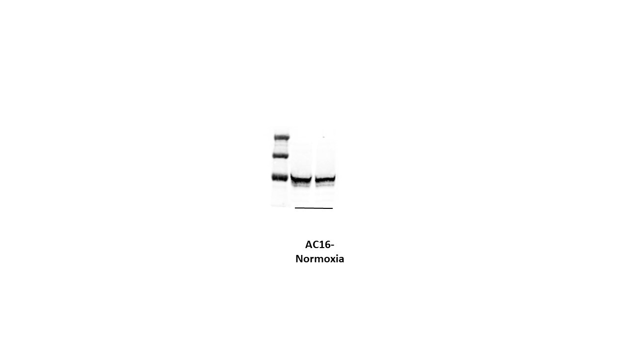 DDX1 Antibody (3E5E2) - BSA Free NBP2-61745