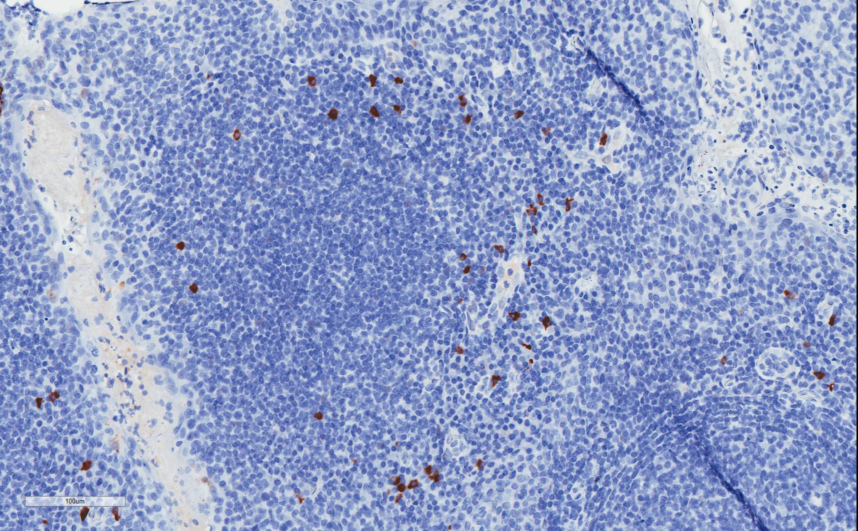 IgA2 Antibody (RM125) NBP2-62025