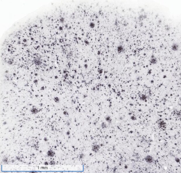 APP Antibody (6E10) - Chimeric - Azide and BSA Free NBP2-62566