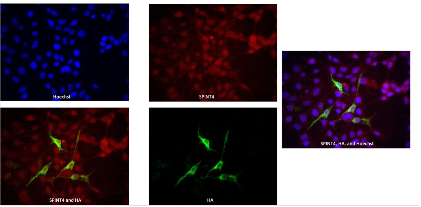 SPINT4 Antibody - BSA Free NBP2-62613