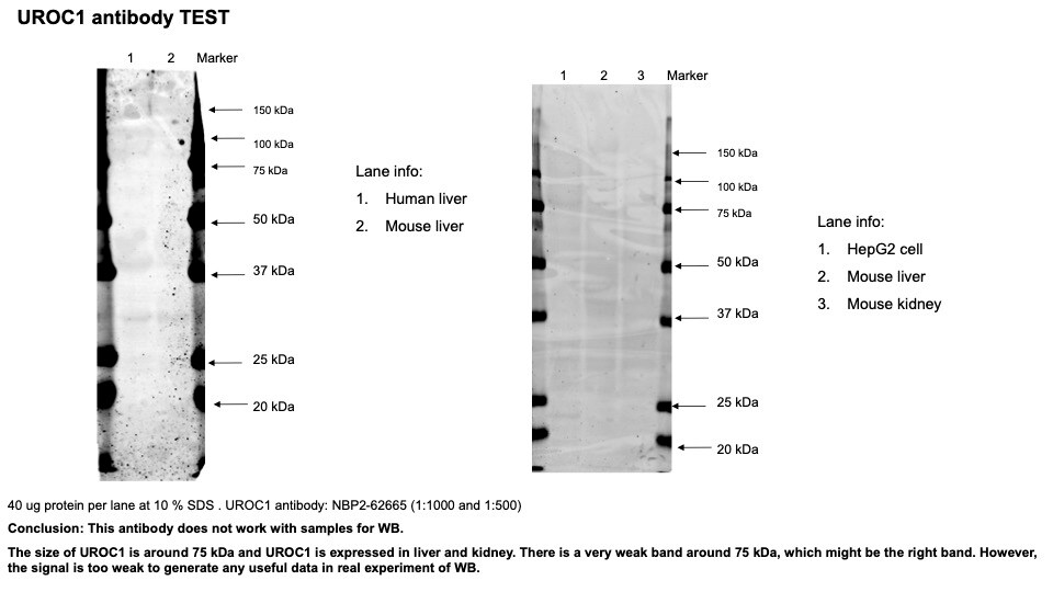 UROC1 Antibody - BSA Free NBP2-62665