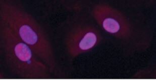 Mouse HMGB1/HMG-1 ELISA Kit (Chemiluminescence) NBP2-62782