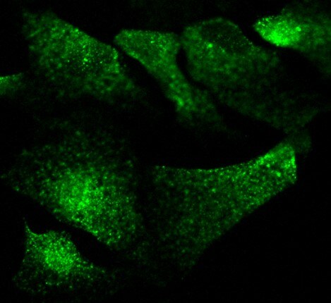 EMMPRIN/CD147 Antibody (JF1-045) NBP2-66820