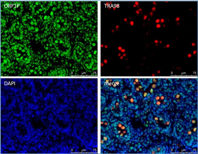 LINE-1 ORF1p Antibody NBP2-66934