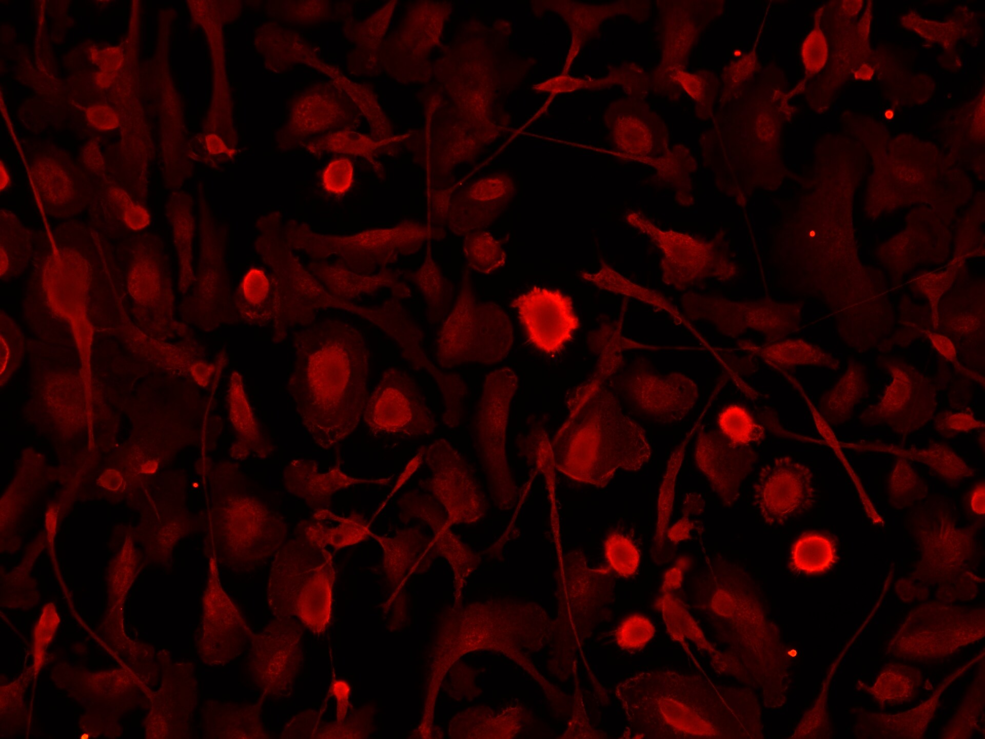 LINE-1 ORF1p Antibody NBP2-66934