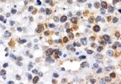 NGFI-B alpha/Nur77/NR4A1 Antibody (JM59-11) NBP2-66980