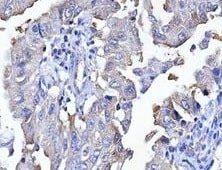AGER Antibody (JF0975) NBP2-67095