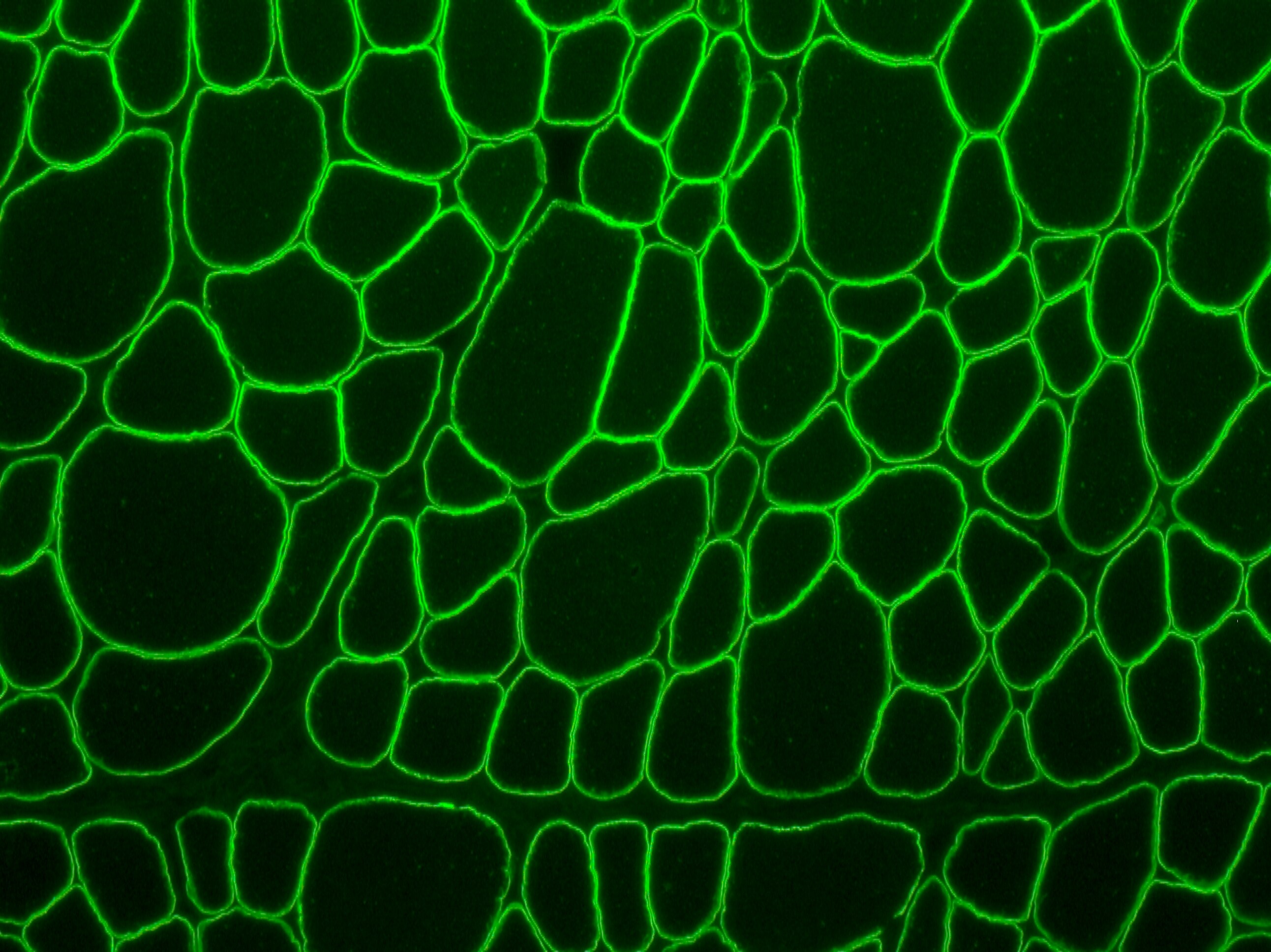 alpha-Sarcoglycan Antibody (JA51-81) NBP2-67150