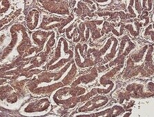 MMP-14/MT1-MMP Antibody (3-F7) NBP2-67415