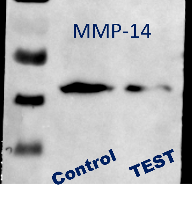 MMP-14/MT1-MMP Antibody (3-F7) NBP2-67415