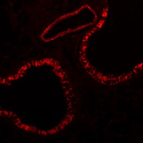 Integrin beta 3/CD61 Antibody (SJ19-09) NBP2-67416