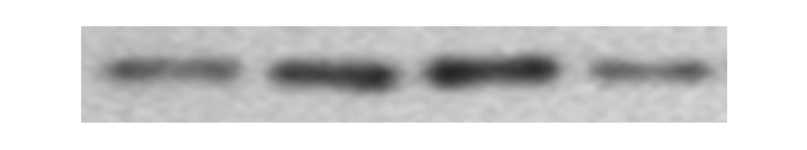 Integrin beta 3/CD61 Antibody (SJ19-09) NBP2-67416