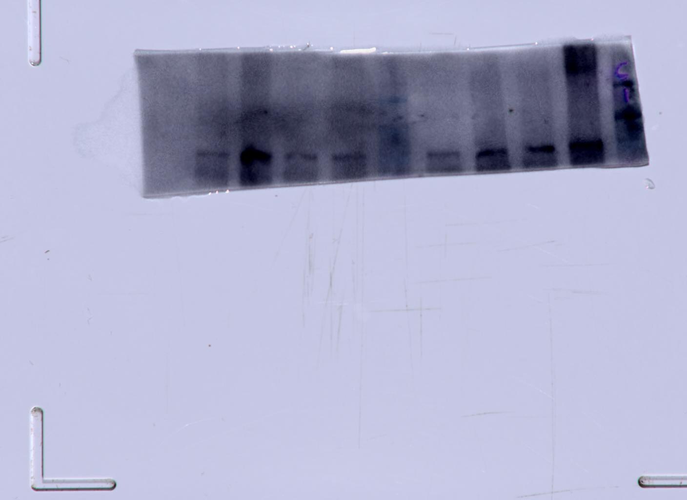 Hexokinase 1 Antibody (ST47-05) NBP2-67503