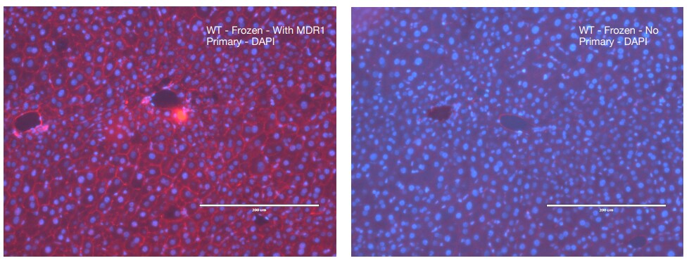 MDR1/ABCB1 Antibody (SN06-42) NBP2-67667