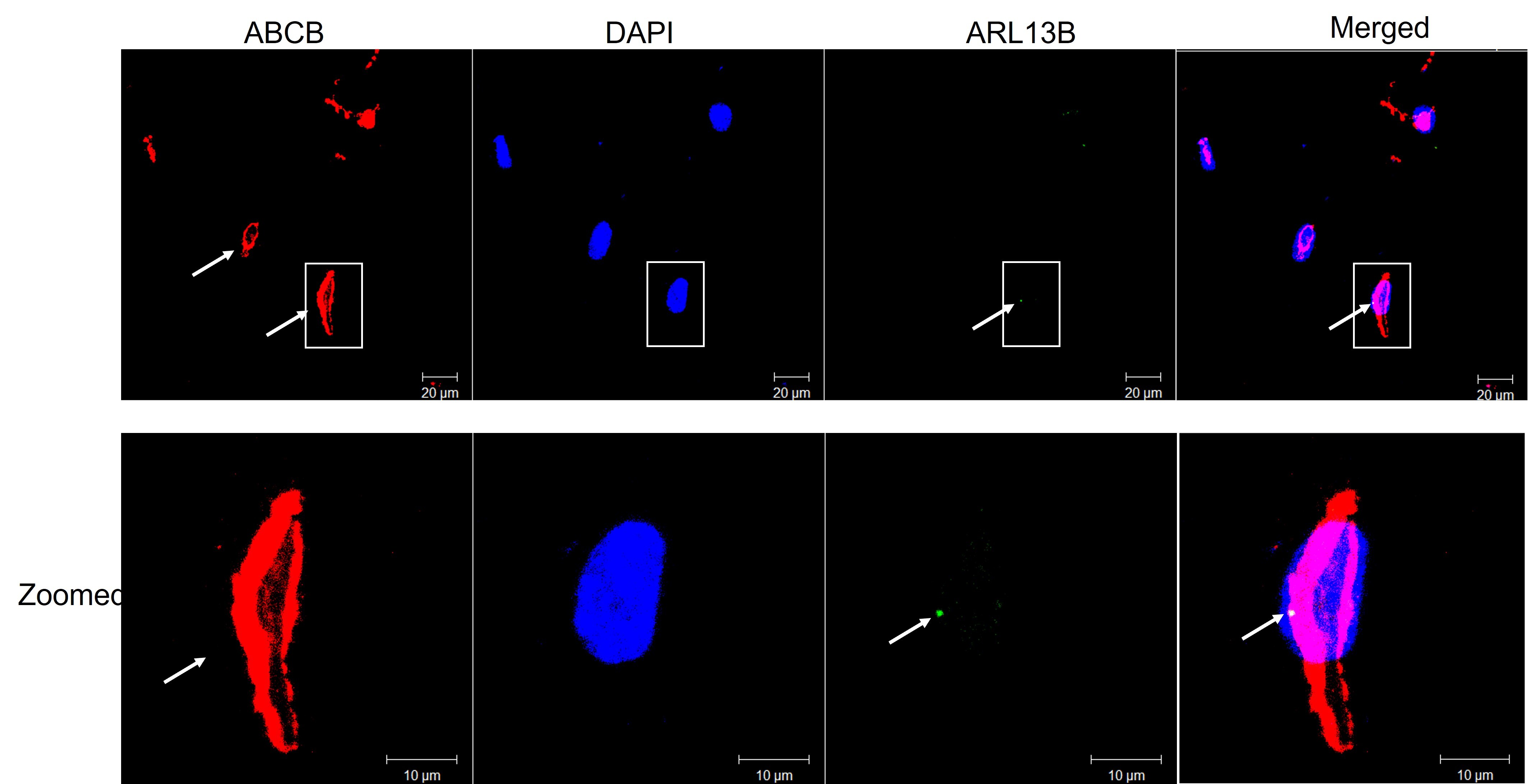 MDR1/ABCB1 Antibody (SN06-42) NBP2-67667