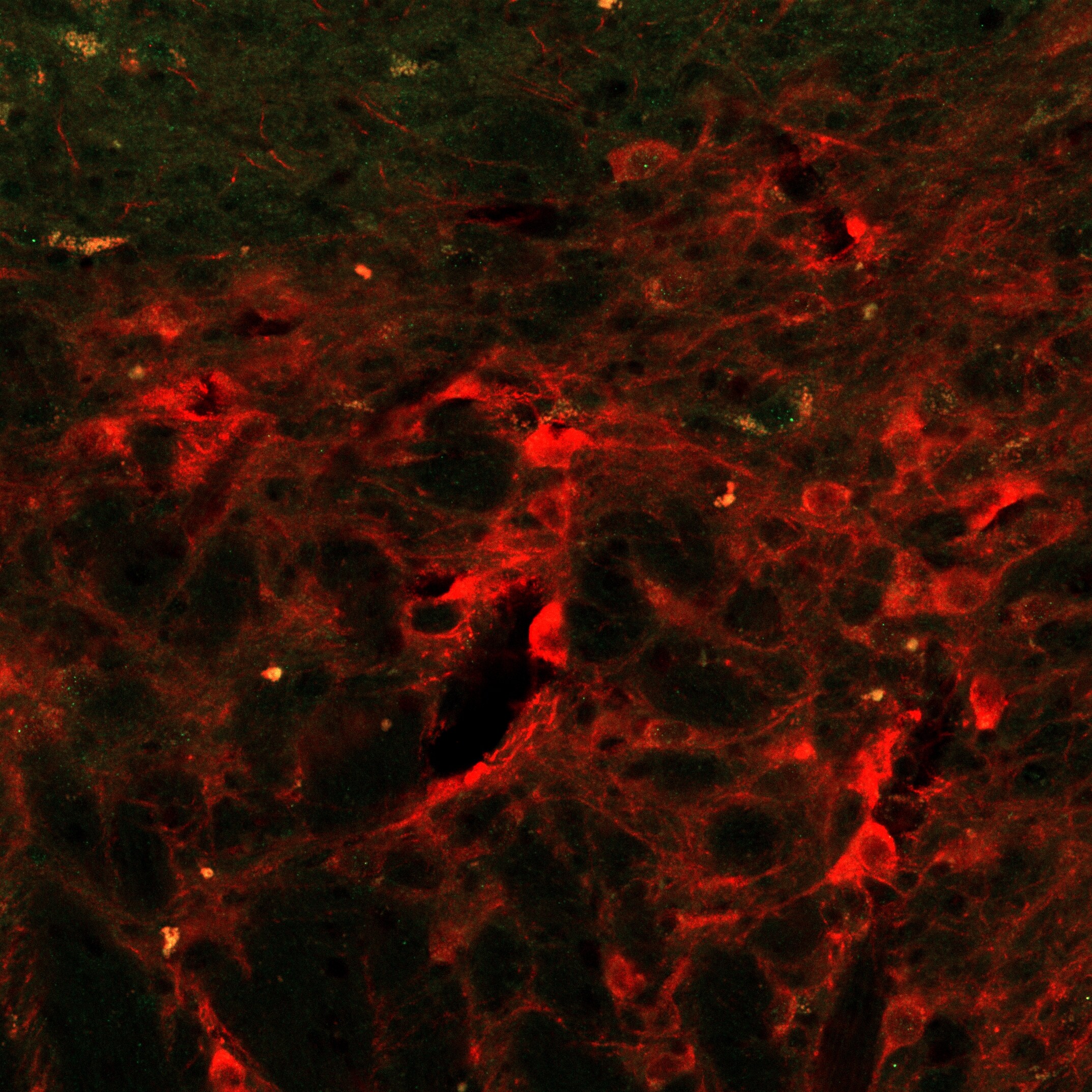 ATF4 Antibody (SD20-92) NBP2-67766