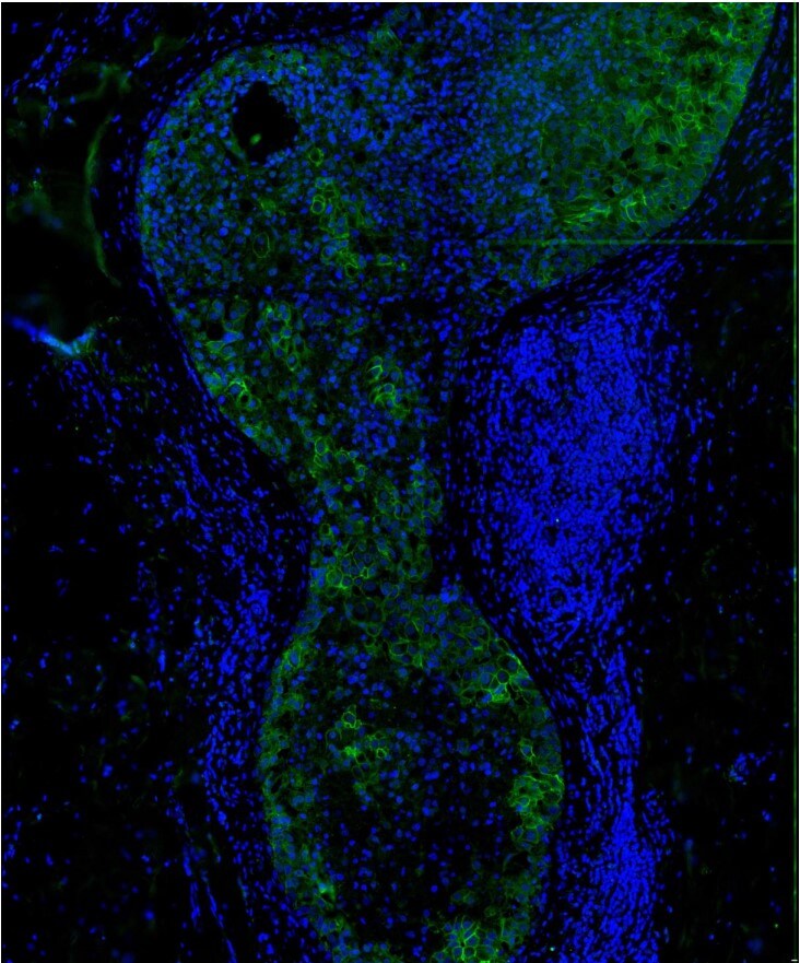 Carbonic Anhydrase XII/CA12 Antibody (OTI2C6) [FITC] NBP2-70329F
