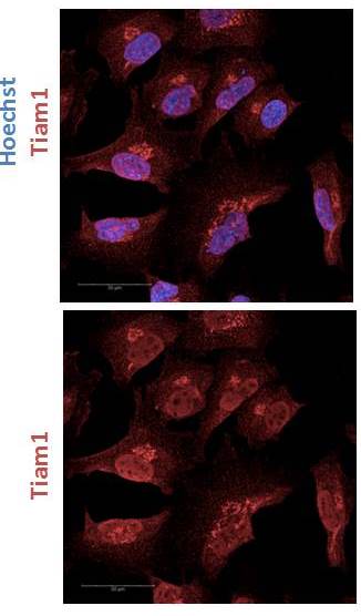 TIAM1 Antibody NBP2-75096