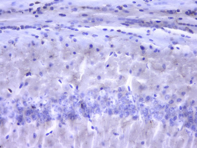 AIF-1/Iba1 Antibody (JM36-62) NBP2-75397