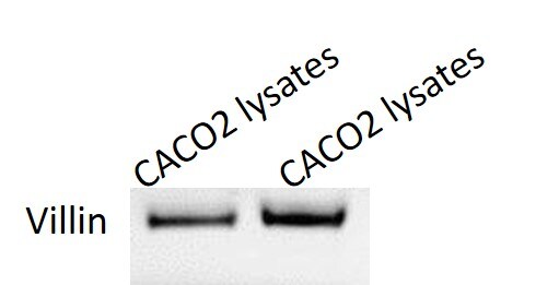 Villin 1 Antibody (JU34-75) NBP2-75707