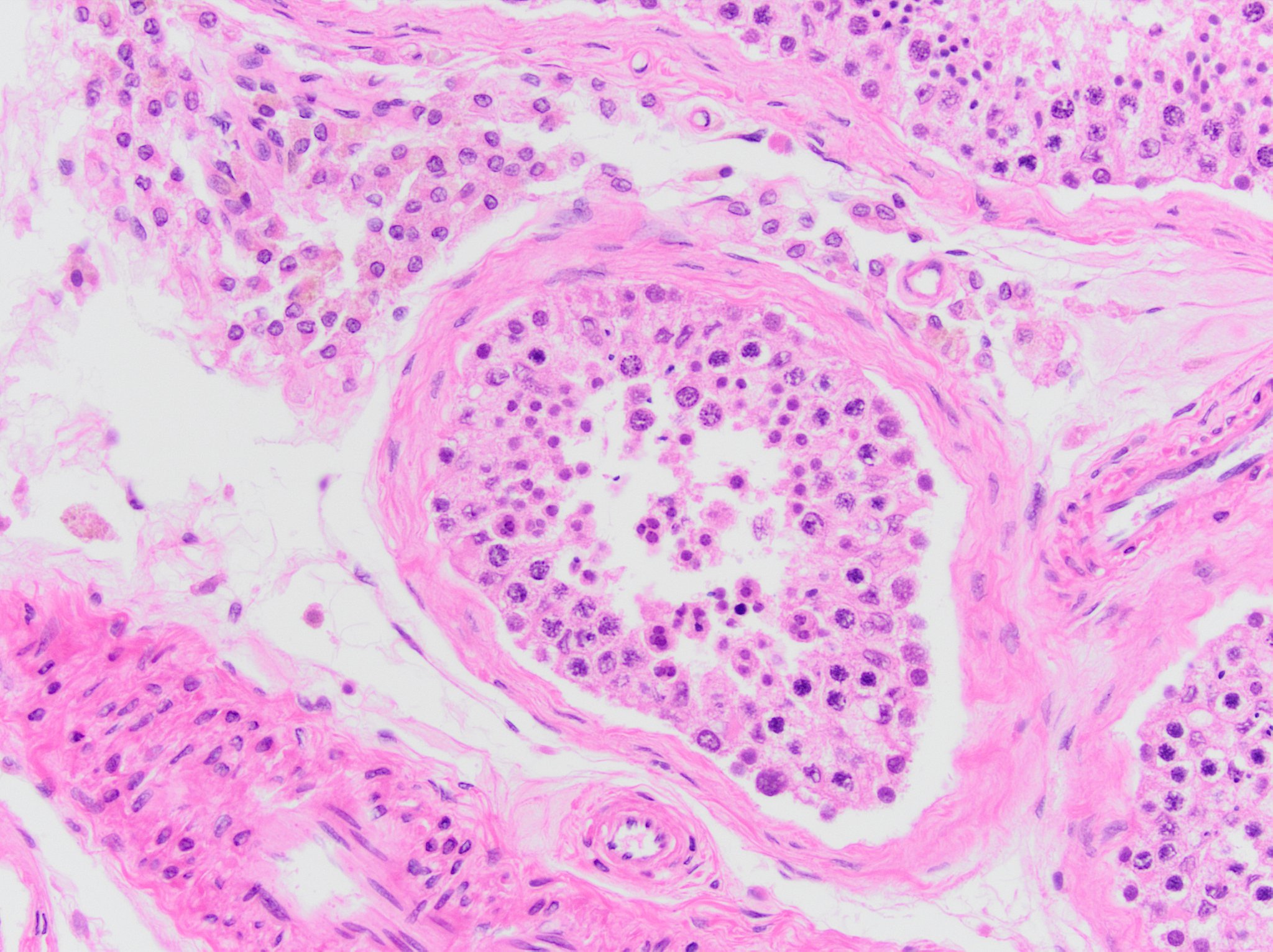 Testis Tissue Slides (Adult Normal)- Paraffin NBP2-75940
