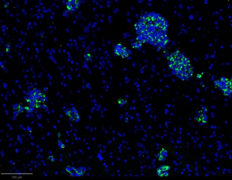 Cytokeratin, pan Antibody (PAN-CK (Cocktail)) [Alexa Fluor® 488] NBP2-76425AF488