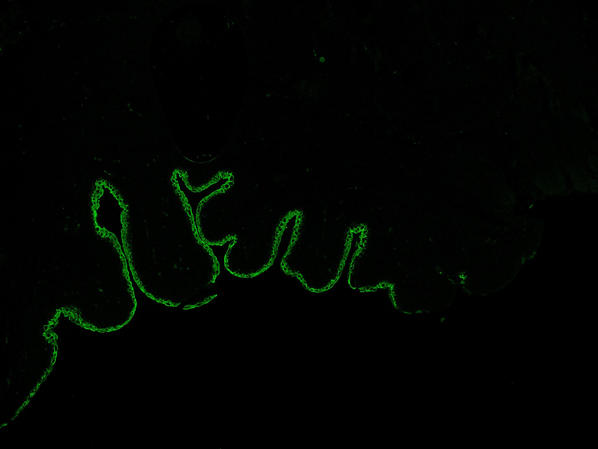 Uroplakin Ia Antibody (UPK1A/2921) NBP2-79733