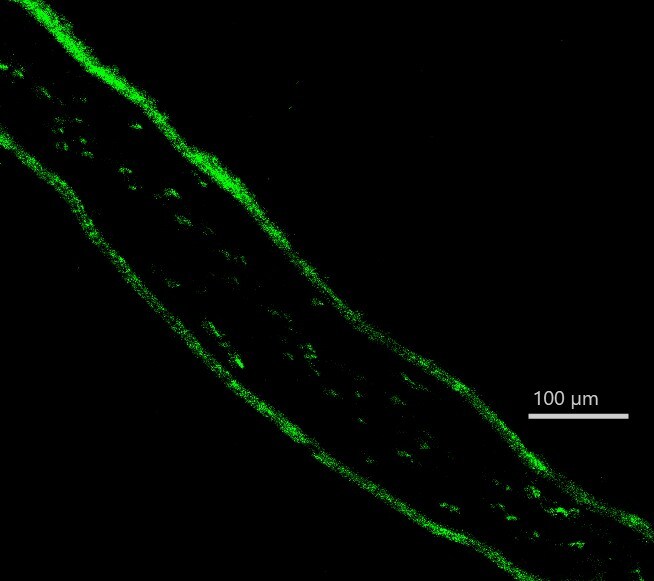 ZEB1 Antibody (2A8A6) - Azide and BSA Free NBP2-81015